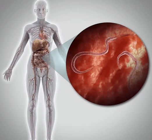 Parásitos no corpo humano