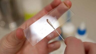 Análise de Calais para identificar os parásitos