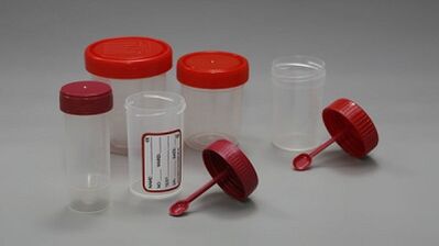 Como prepararse para a proba de parasitos