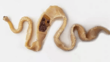 Como descubrir a presenza de parásitos no corpo